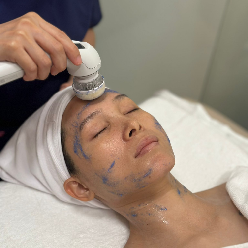 Wishpro Radiance Capsule